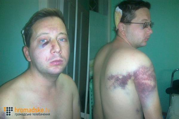 Так выглядел Сергей после задержания